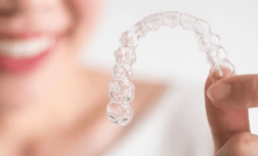 Which Clear Aligner Is Right for You? Honest Comparison of Angel Aligner, Invisalign®, and Spark Aligners Which Clear Aligner Is Right for You? Honest Comparison of Angel Aligner, Invisalign®, and Spark Aligners