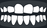 Crooked teeth