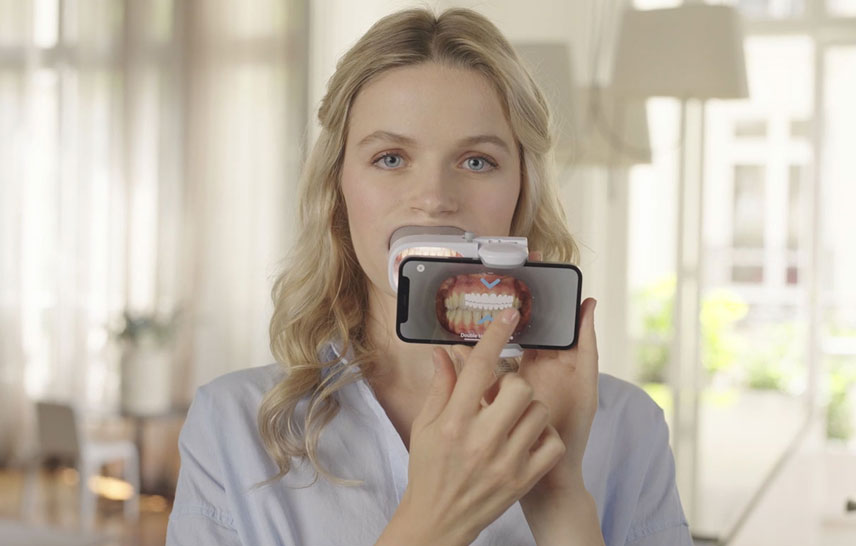 How Dental Monitoring keeps your orthodontic treatment on track